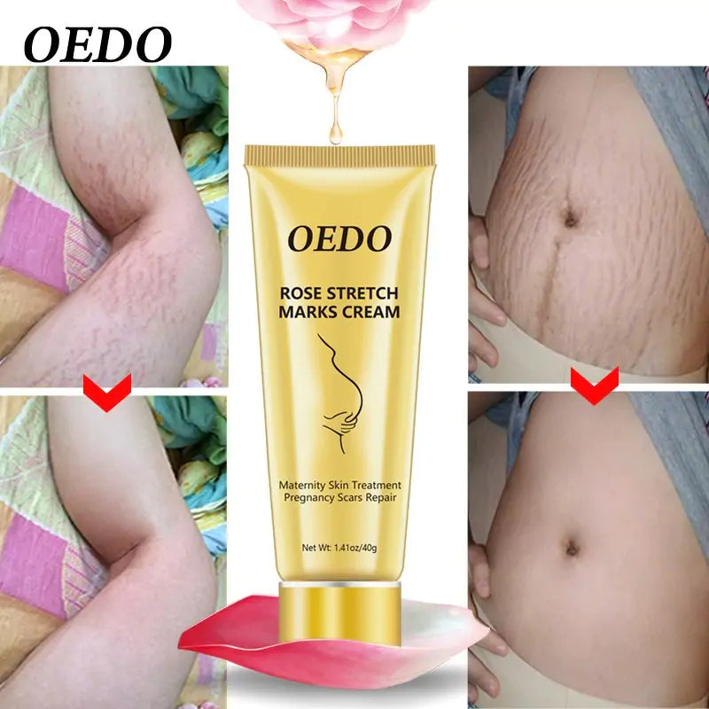 Rose Stretch Marks Cream