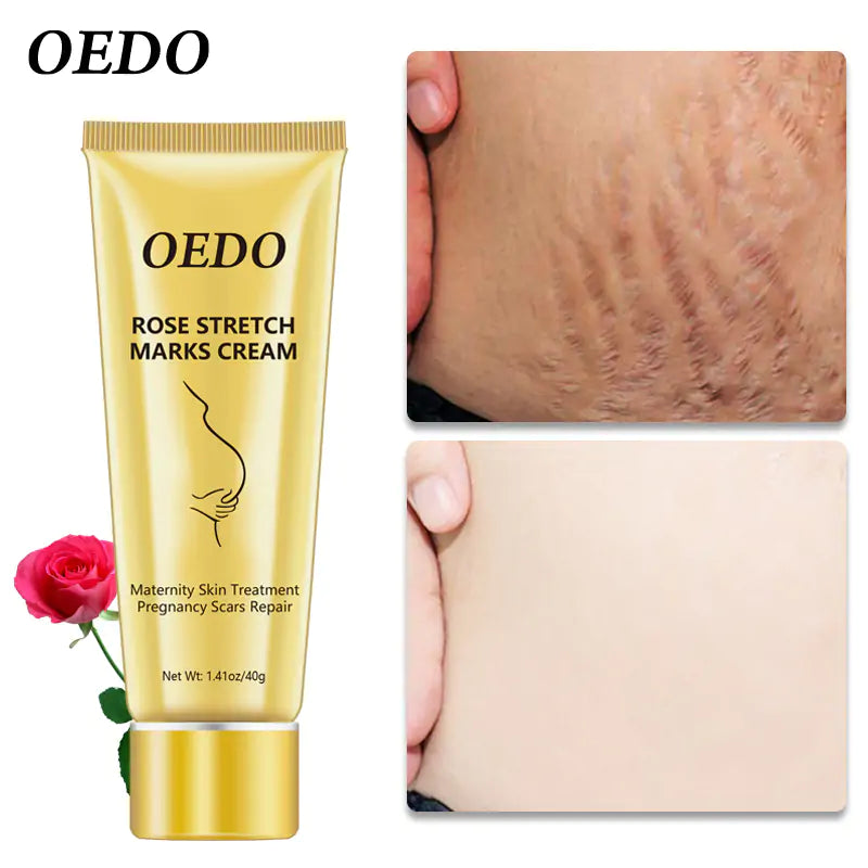 Rose Stretch Marks Cream