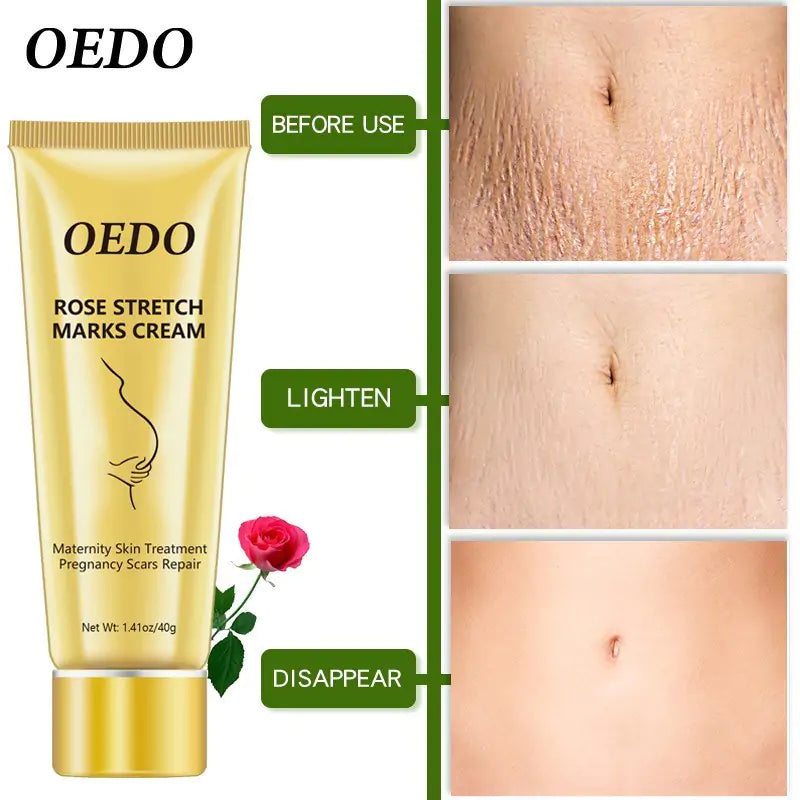 Rose Stretch Marks Cream